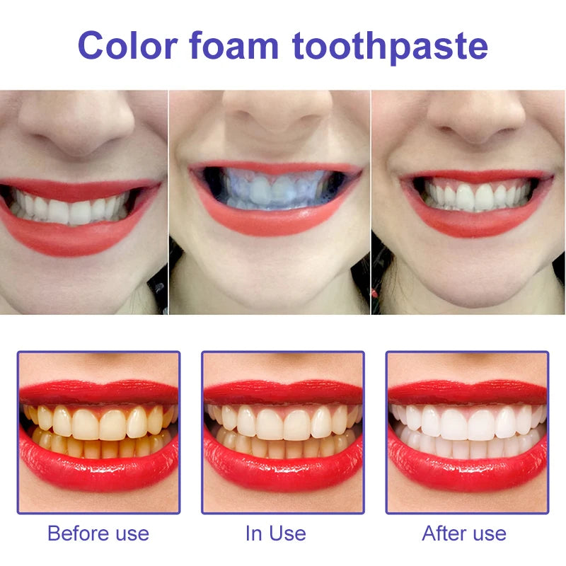 Hismile Purple Toothpaste Whitening Toothpaste